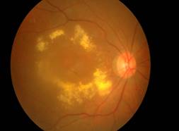 eye