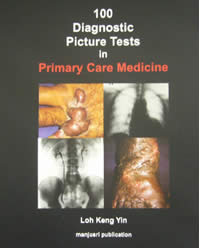 100 Diagnostic picture tests in Primary care