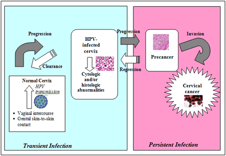 Figure 2. Schematic representation of HPV infection
