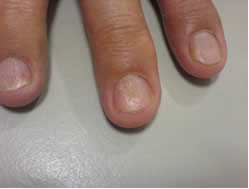 Right Fundus