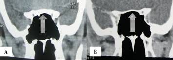 Figure 4: CT brain